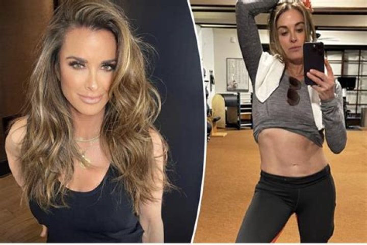 
Kyle Richards Weight Loss Journey- Before And After Photo 